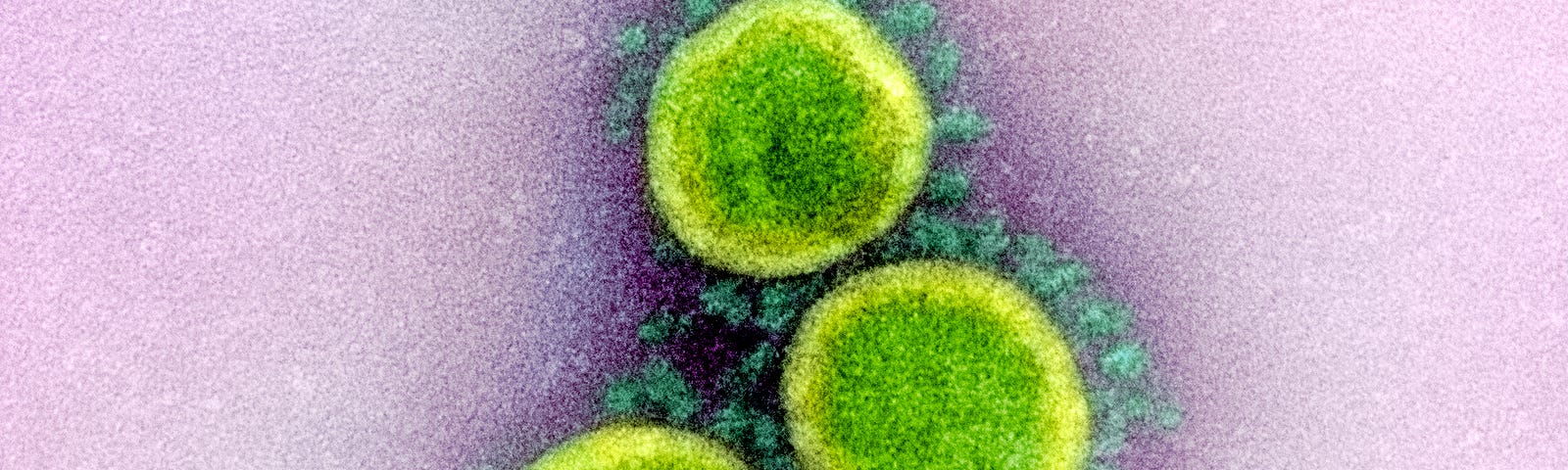 Transmission electron micrograph of SARS-CoV-2 virus particles, isolated from a patient. Image captured and color-enhanced at the NIAID Integrated Research Facility in Fort Detrick, Maryland.