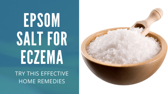 Epsom Salt Baths for Eczema