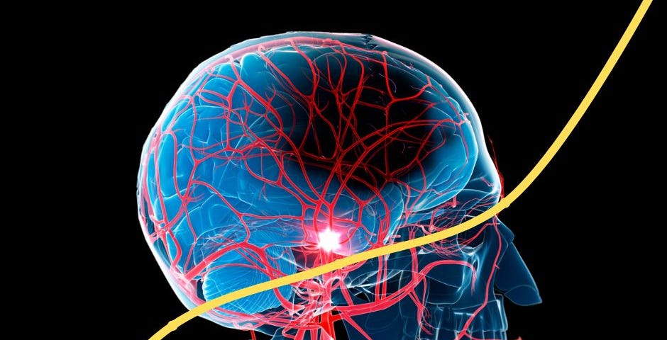 A graphic by the author showing the inner-workings of the brain with a highlighted area indicating a stroke. In the foreground is a line chart with a low value on the left indicating the time of stroke. The line increases in value as the individual continues through recovery.