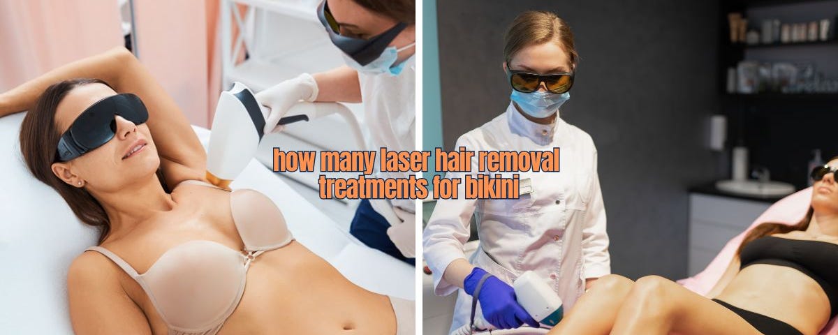 How Many Laser Hair Removal Treatments for Bikini