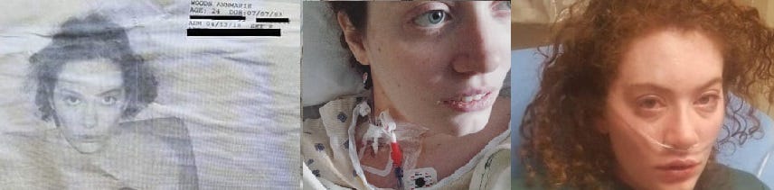 3 photos of the author: a psych ward ID photo, wearing a hospital gown with a neck port, wearing an oxygen cannula.