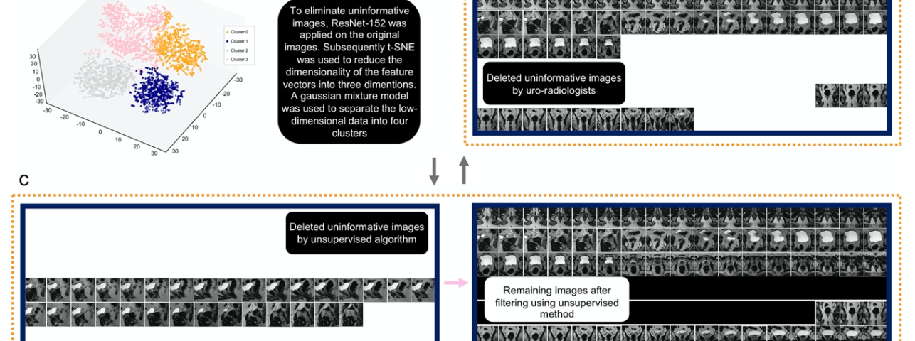 Figure 1: Preprocessing approach to generate informative images for each patient. (a) Each patient’s MRI series contains diff