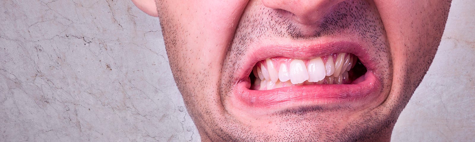 man gritting his teeth