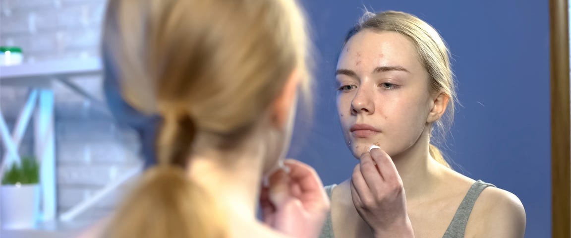 woman with acne looking in the mirroe