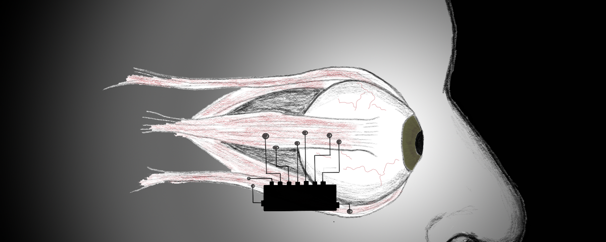 A pencil sketch of a computer chip with leads that attach to the muscles of an anatomical eye