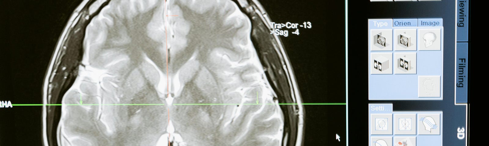 A black and white view of a brain scan.