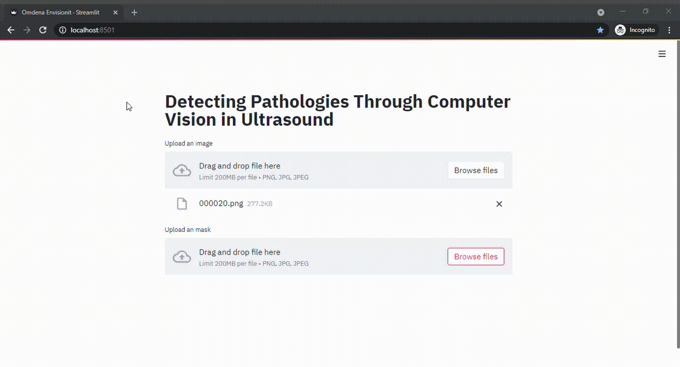Source: Omdena Visualizing Pathologies in Ultrasound Image using OpenCV and Streamlit