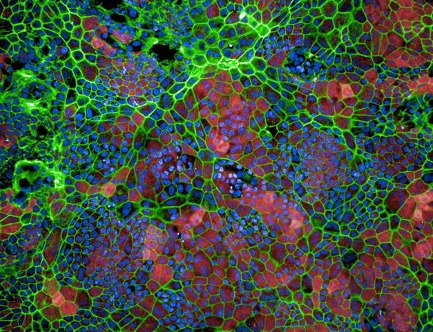 Stem cell-derived retinal pigmented epithelial cells. The cell walls are bright green, and filled with pinks and blues. Image credit: Cecile Terrenoire, PhD