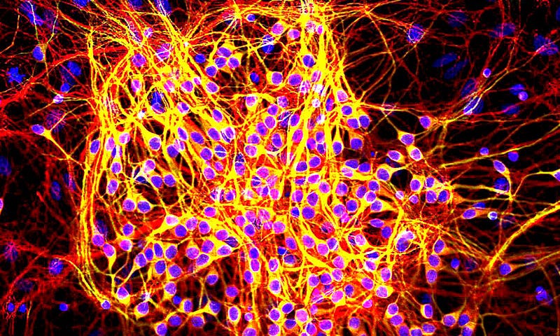 Yellow and blue fluorescent image of a neuron tangle