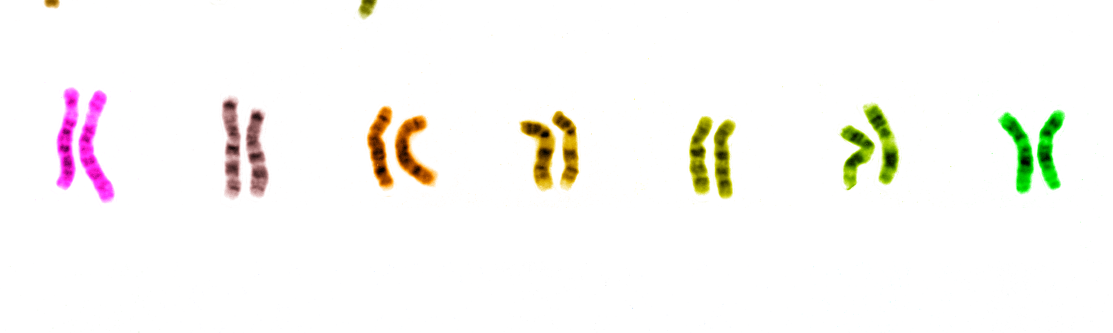 IMAGE: Human chromosomes, colored by UCSC browser default colors