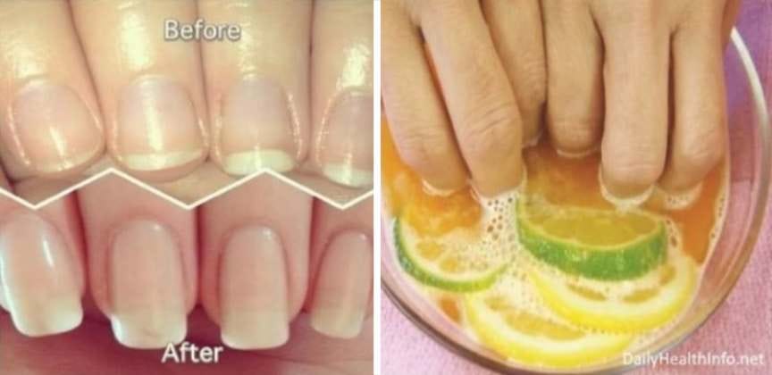 nail growth