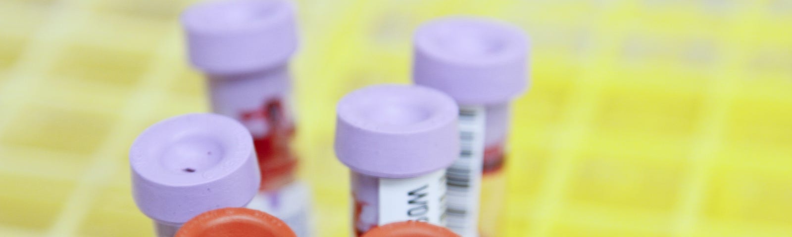 Blood test tubes with barcode labels and brightly coloured caps.