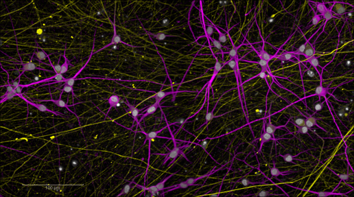 Stem cell-derived neurons in purple and yellow on a black vbackground. Image credit: Barry McCarthy
