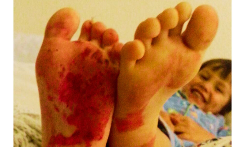 Young child giggling showing the soles of his feet covered in red nail polish.