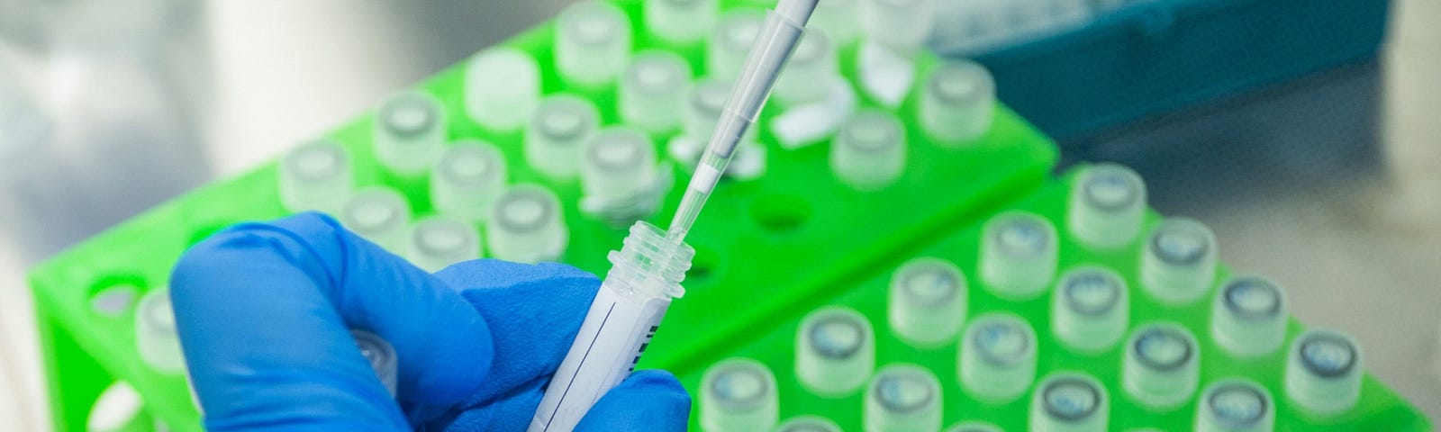 A lab technician uses a single channel pipette dropper to test material during Covid-19 polymerase chain reaction (PCR) test processing at a laboratory in the Dunkeld suburb of Johannesburg, South Africa, on Wednesday, Feb. 10, 2021. Scientists are concerned the South Africa coronavirus strain could be far more widespread in the U.K. than test results show, threatening plans to start lifting lockdown once vaccines have been deployed. Photographer: Waldo Swiegers/Bloomberg