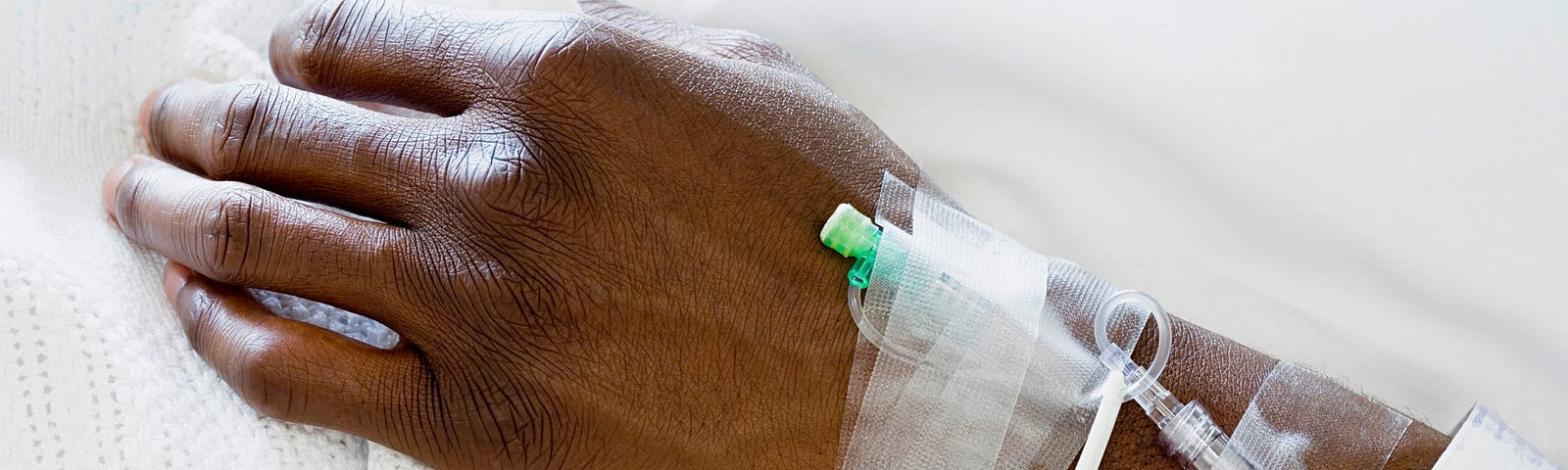 Closeup of hand of a patient at hospital with IV drip.