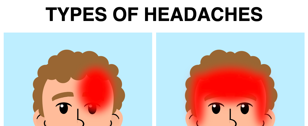 Cartoon titled ‘Types of headaches’ with four panels showing a person with a red are indicating the zone of the headache, and a title underneath it indicating the type of headache. The first panel is for Migraine, and the red area occupies the right side of the forehead and eye. The second panel is for stress, and the red area is the forehead and both sides of the head. The third panel is for tension, and the red area is around the forehead. The fourth panel is for Tailwind and everything is red