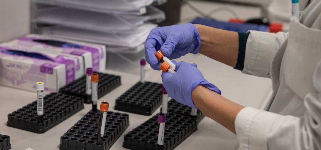 A photo of a nurse holding blood sample vials in a lab. She is wearing purple gloves.