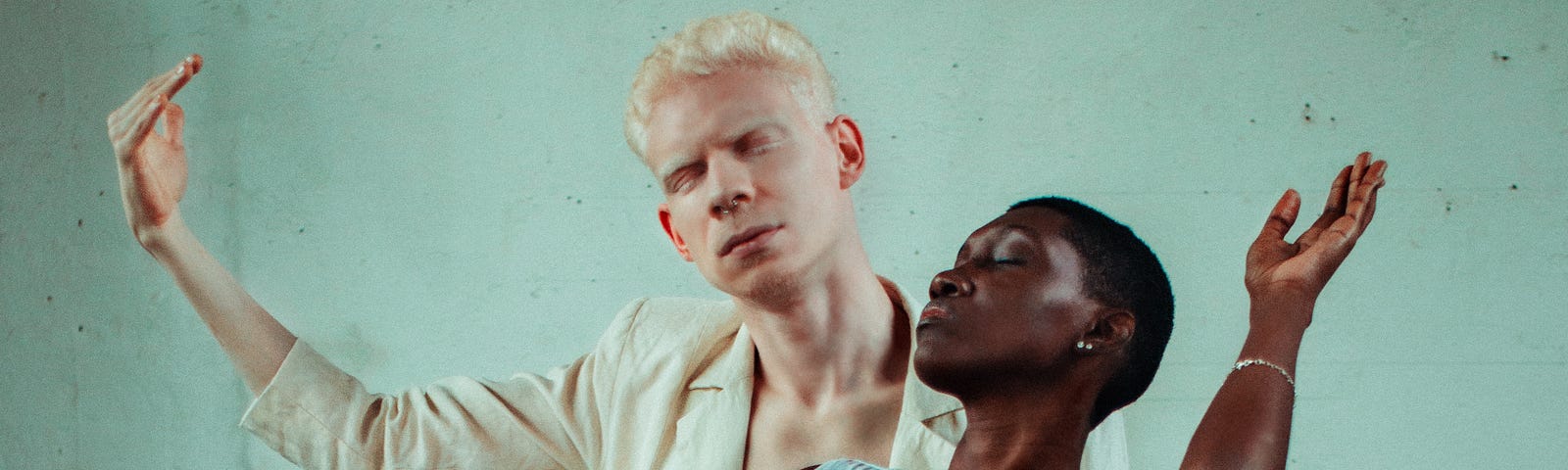 a black woman and an albino man dance