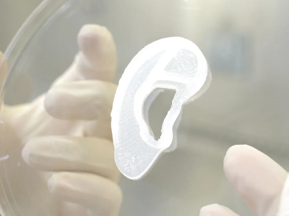 A 3D-printed ear implant created by Aurinovo, designed to replace missing or damaged parts of the ear. This innovative medical implant offers a customizable solution for reconstructive surgery.