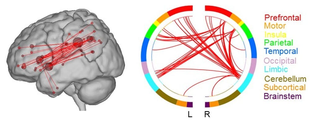 Two renderings show the lobes of the brain that are connected in the high creative network.