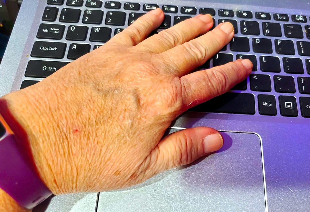 A woman’s left hand is resting palm down on the keyboard of a laptop, the thumb is resting on the touchpad. A purple watch wristband is on her wrist.