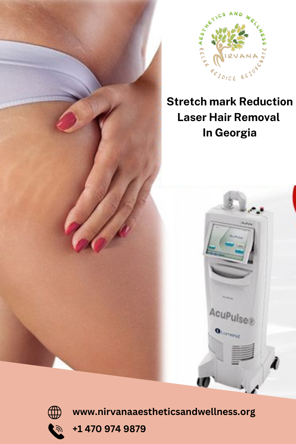 Stretch mark Reduction | Laser Hair Removal In Georgia