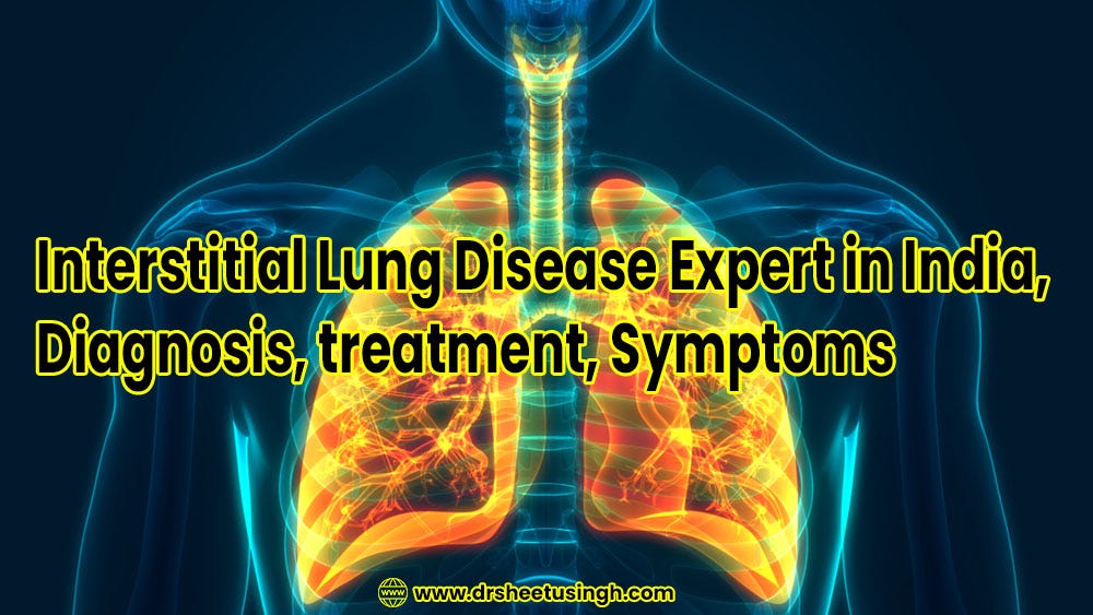 Best Interstitial Lung Disease Expert in India for Treatment