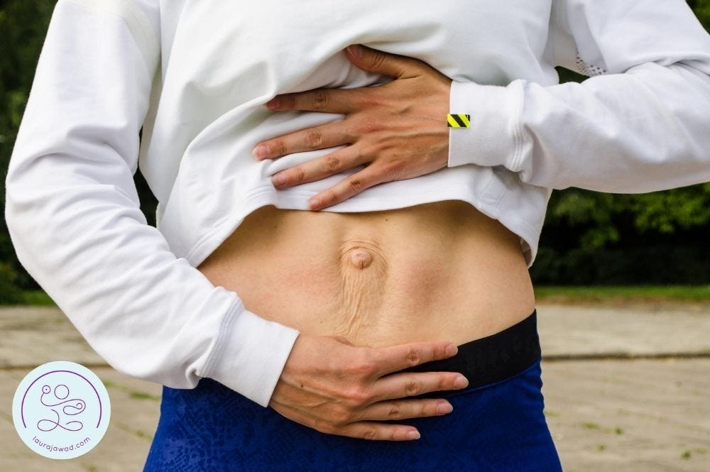 White woman lifting her shirt to reveal 2-finger width diastasis recti (abdominal separation) around the belly button.