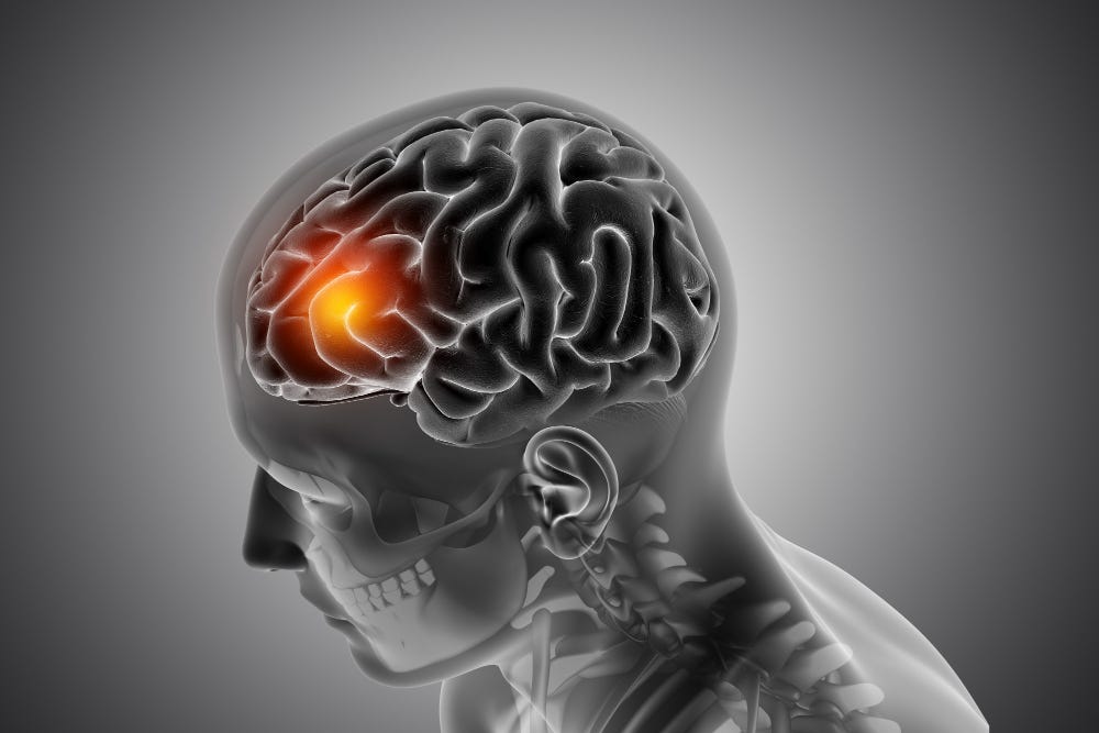 Transfer Learning on Brain MRIs