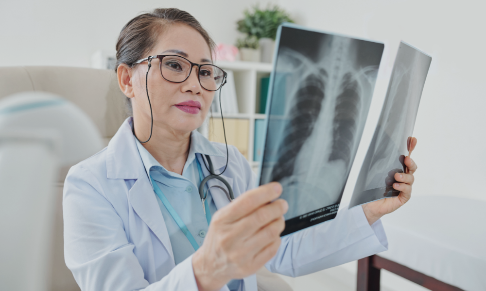 Mastering Lordotic Chest X-rays: Radiologist Guide