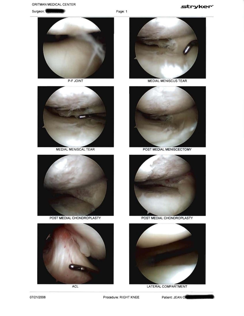 A photo of a page with eight images of the inside of a knee during arthroscopic surgery. Each image is round and inside a square box, with print indicating what each image is.