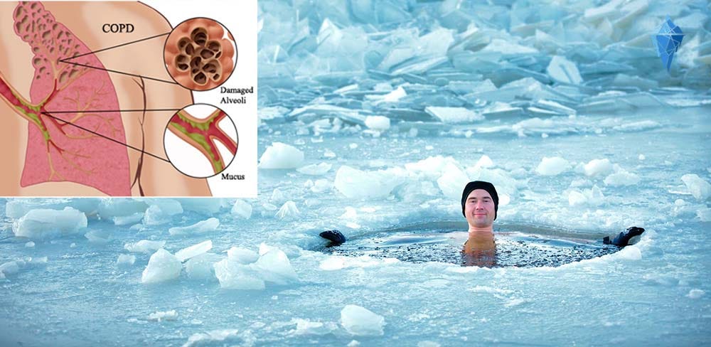 a guy in an ice hole benefiting from cold water therapy