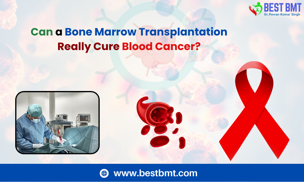 cure blood cancer with bone marrow transplant