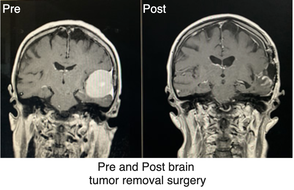 Classification of Radiology Reports into Surgical and Non-Surgical Categories Using GPT-4 APIs