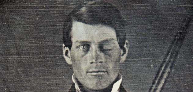 Phineas Gage close-up