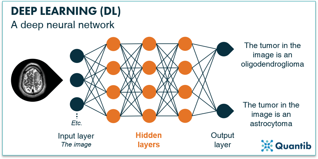 schematic figure illustrating deep learning in radiology with a brain MRI going through a deep neural network