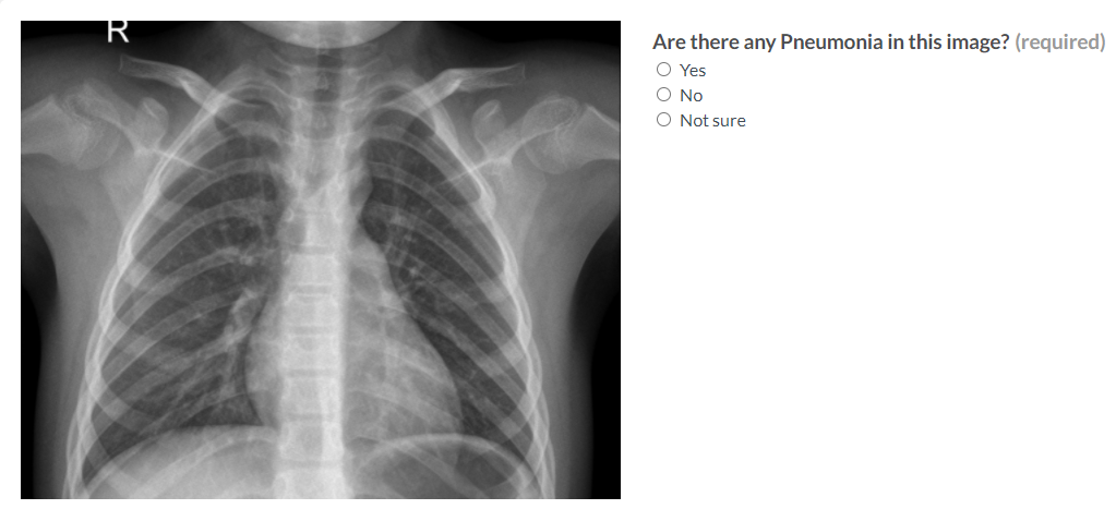 A chest x-ray image on the left and a question with three answer options on the right.