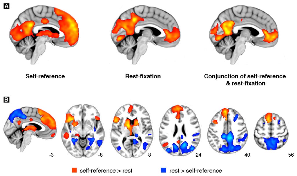 Brain activations during self-reference and rest show considerable overlap, but also distinct differences.