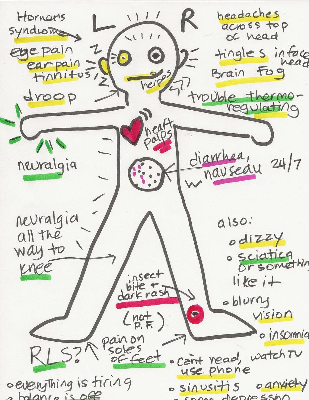 A Lyme patient’s drawing of where they were experiencing symptoms when trying to get diagnosed. Illustrates a human body with arrows pointing to affected body parts.