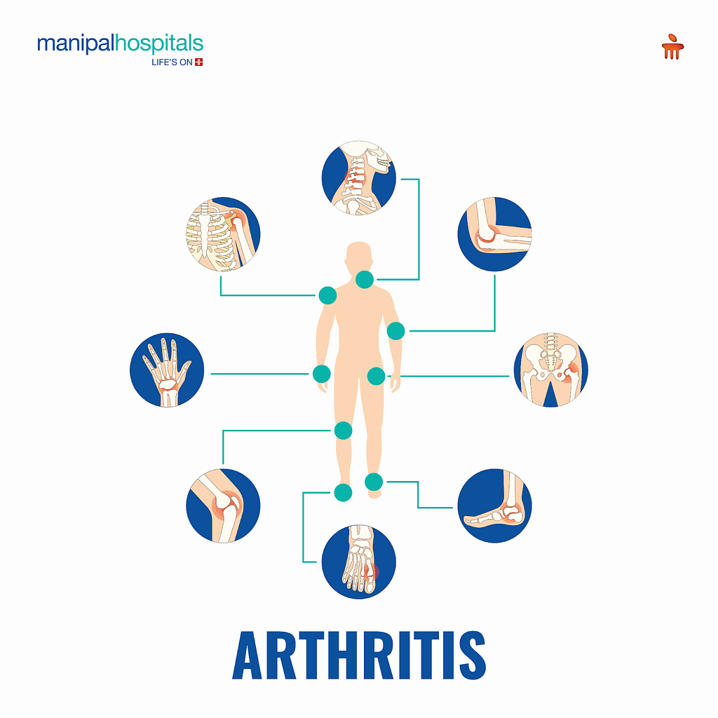 Arthritis