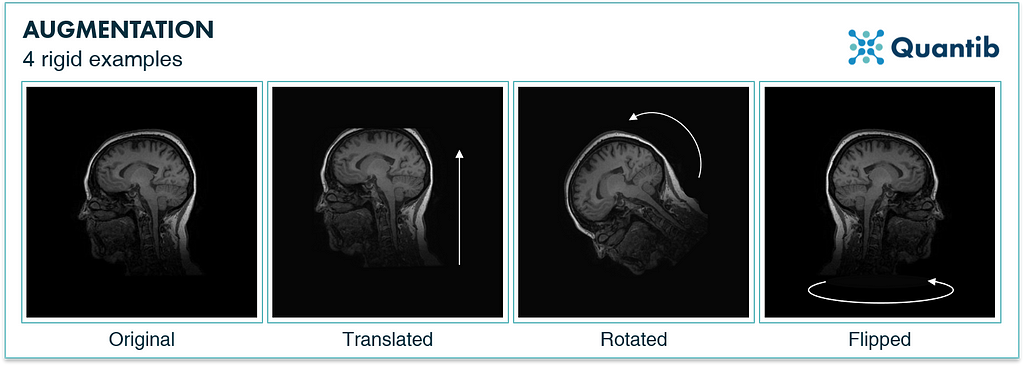 four examples of rigid image augmentation illustrated with medical images