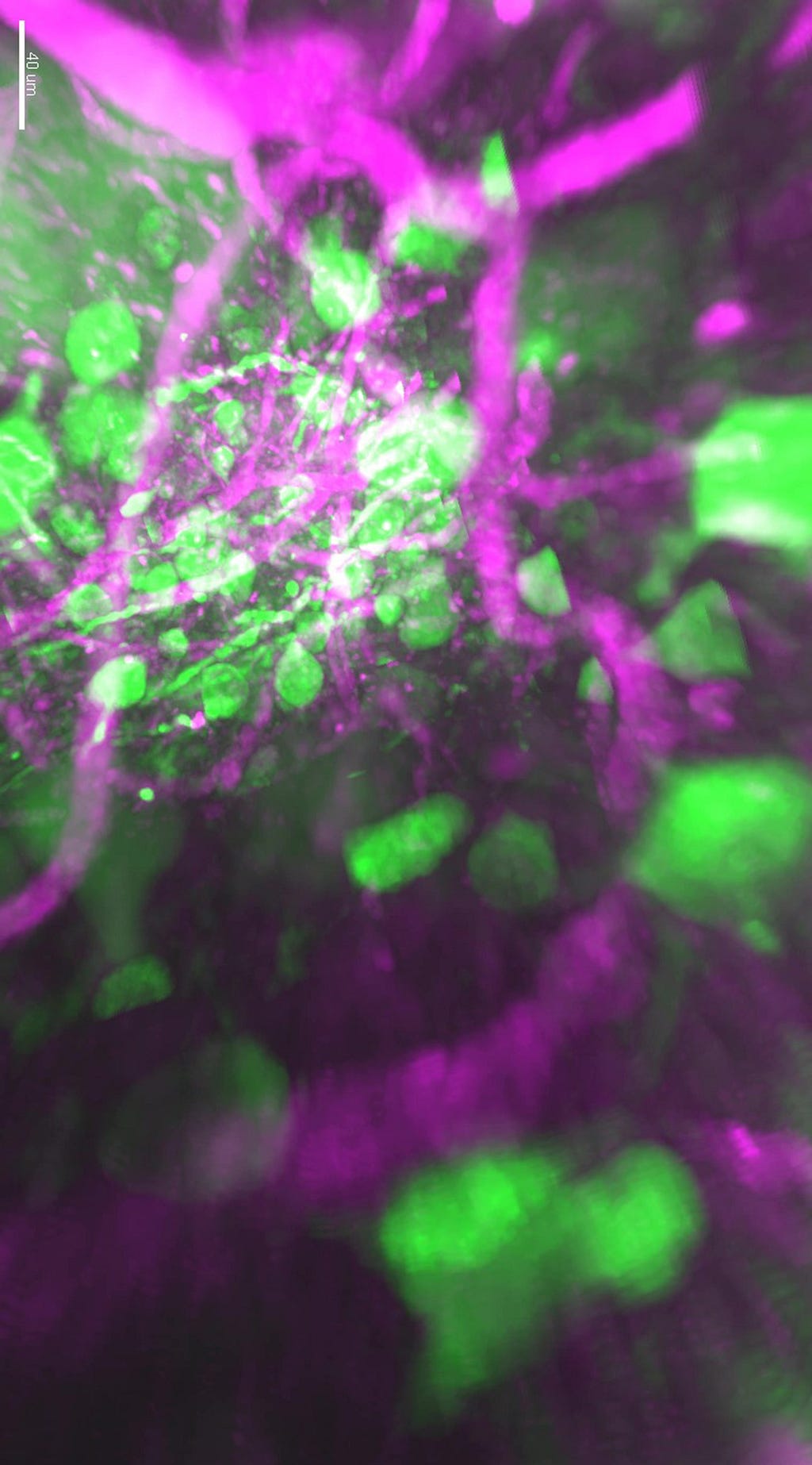 A viewer seems to peer downward through deep tangle of neurons in green and white matter tracts in magenta are