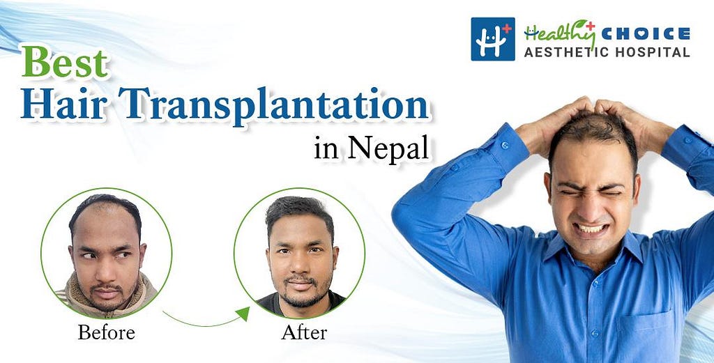 best hair transplant in nepal Healthy Choice Aesthetic Hospital