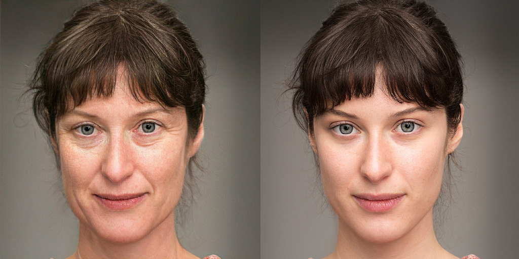 Radiant Beauty Before Vs After Effect
