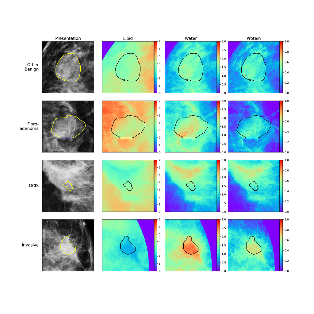 Compositional heat map for cancerous and non-cancerous breast lesion types. Redder colors indicate thicker regions while bluer regions represent thinner or no thickness.