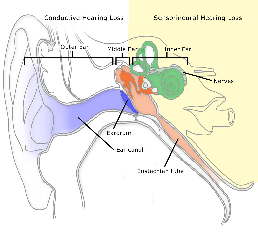 Can Hearing Loss And Tinnitus Cause Vertigo? Uncover the Facts