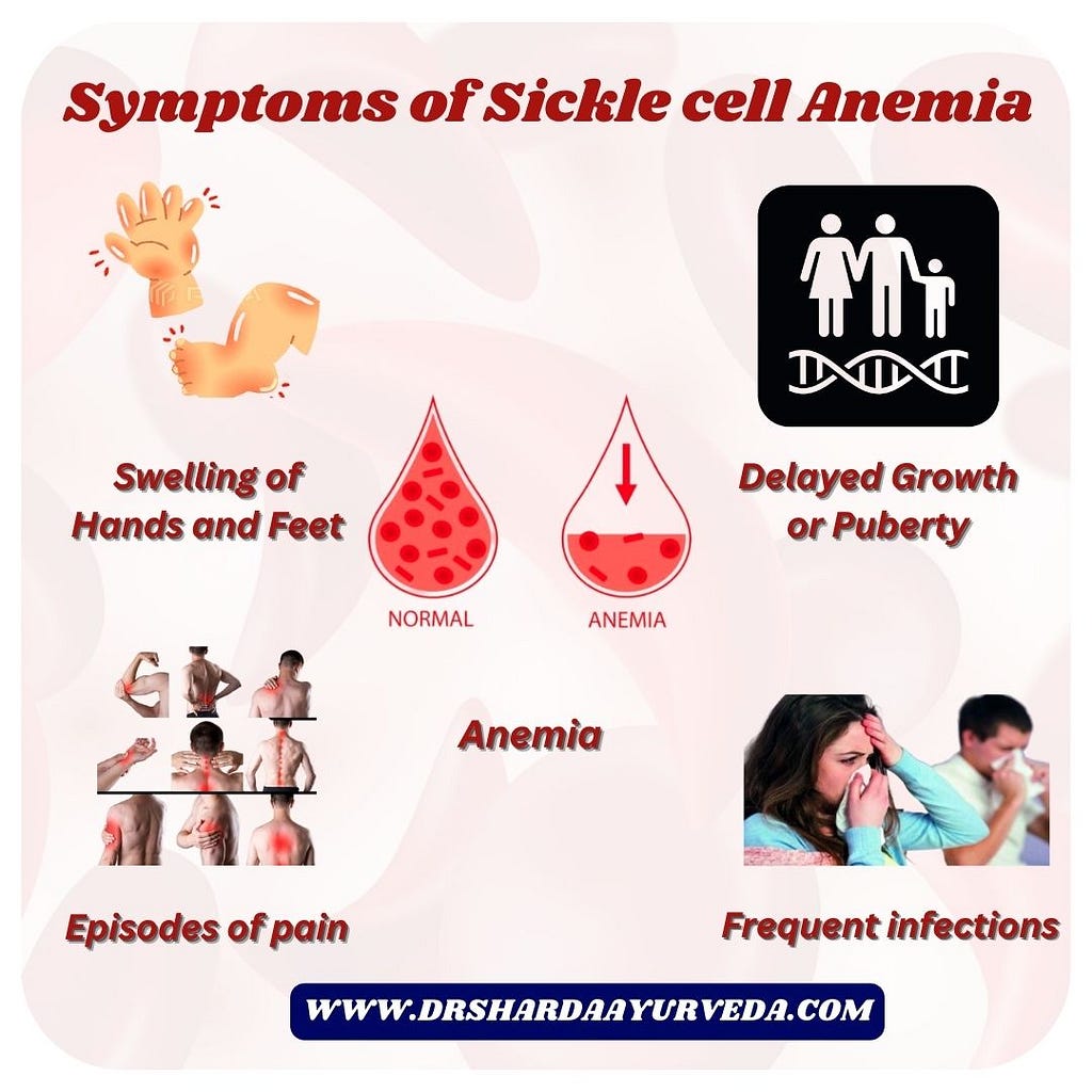 Symptoms of Sickle cell anemia