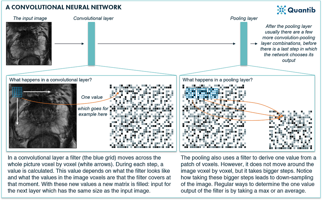 medical image segmentation of the prostate using a convolutional neural network explained in a schematic figure