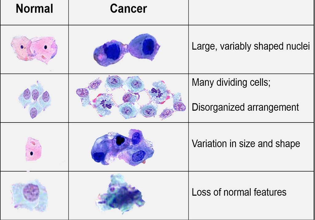 https://www.kiipbydrsaghiv.com/post/cancer-simplified-part-ii